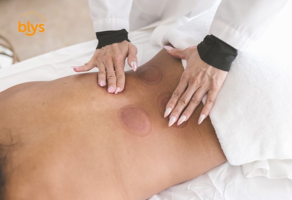 benefits of cupping therapy