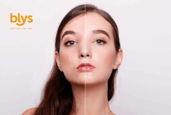 Portfolio photography showing a woman’s face split vertically: blemished skin on one side, smooth radiant skin on the other, conveying transformation. Blys logo on top left side.
