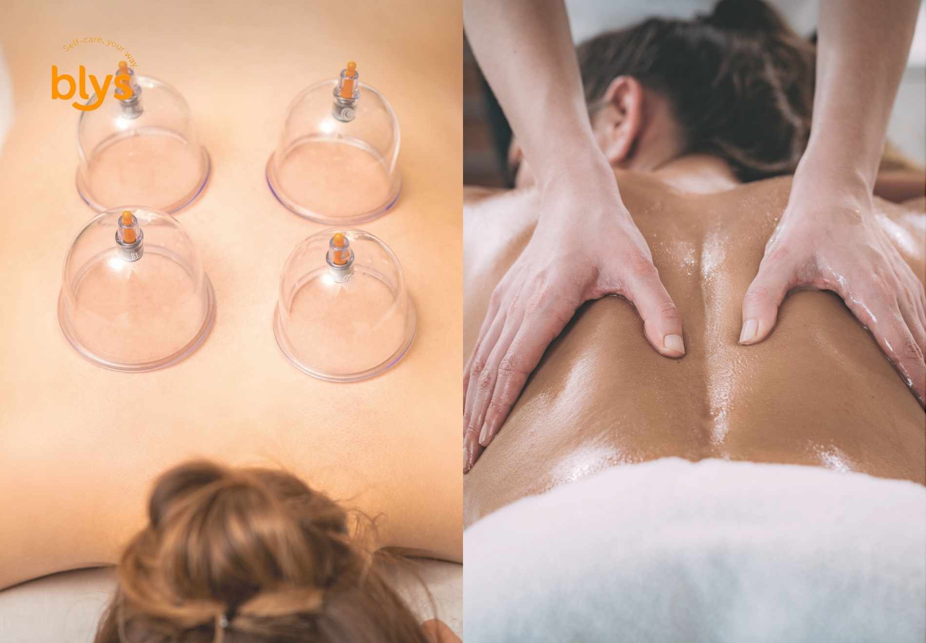 Cupping vs. Massage Therapy