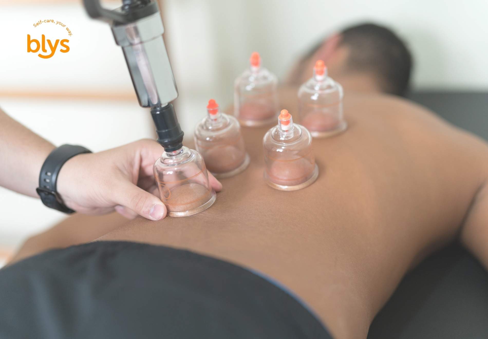 DIY Cupping Therapy