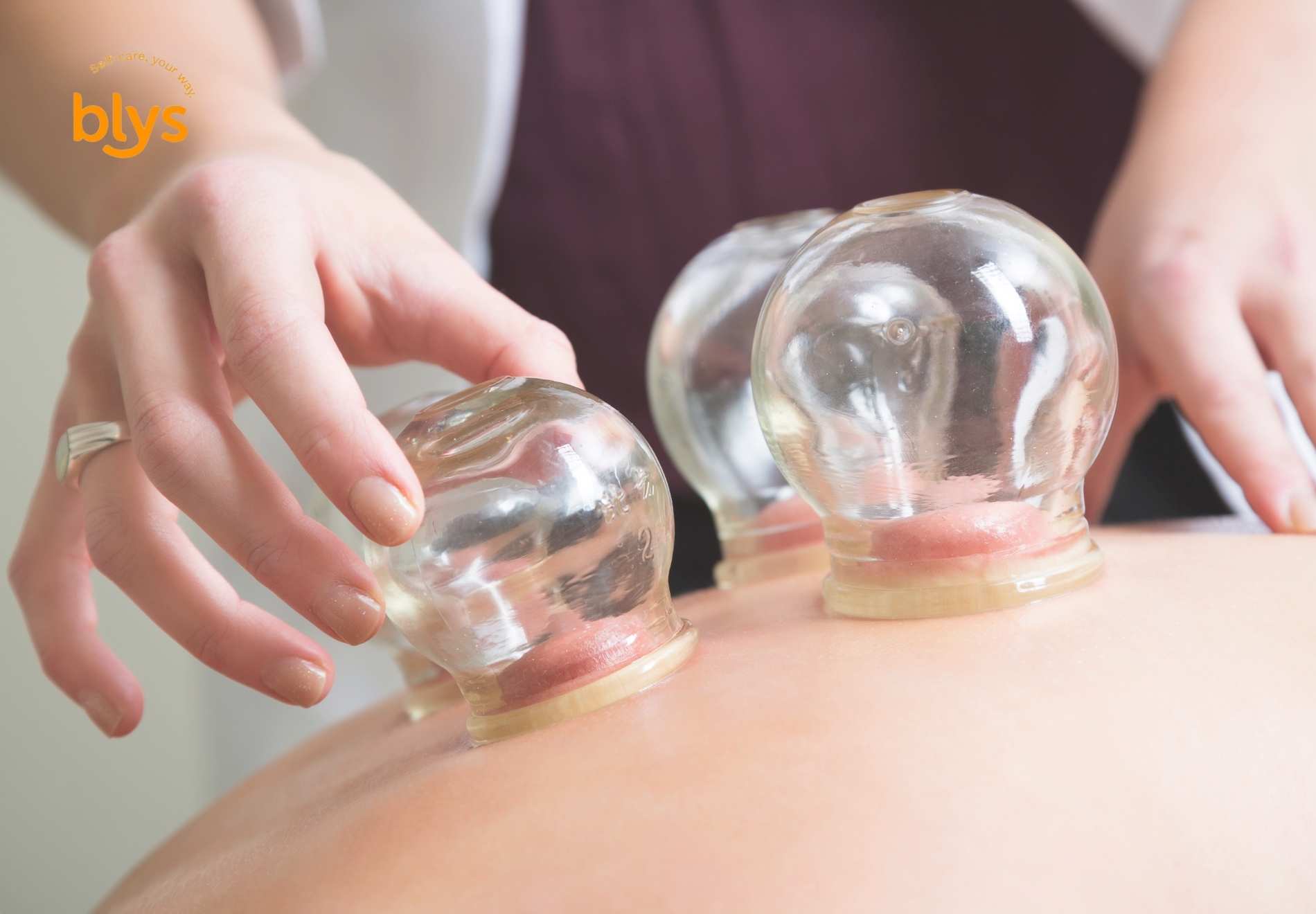 Health Benefits of Cupping Therapy