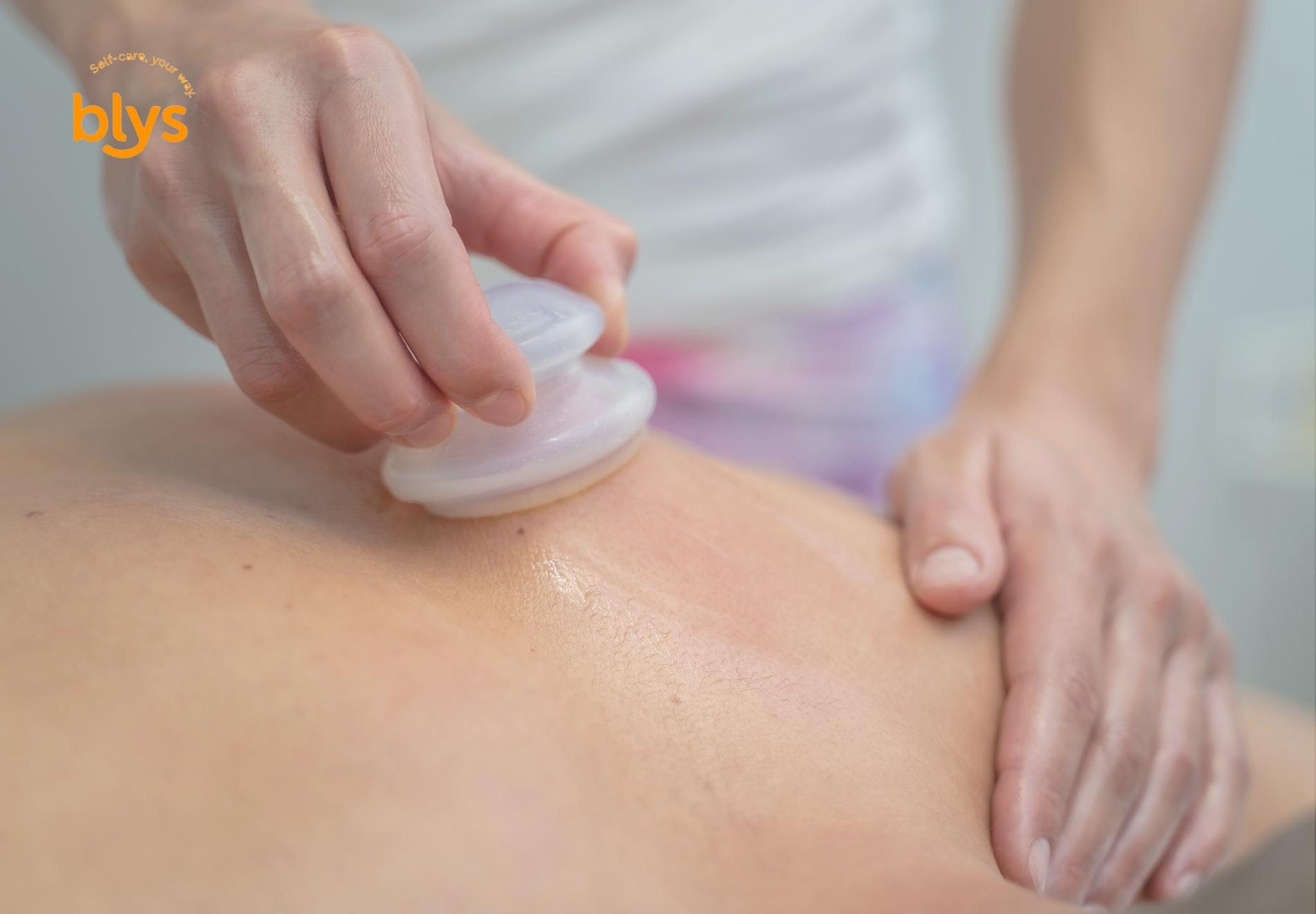 History of Cupping Therapy